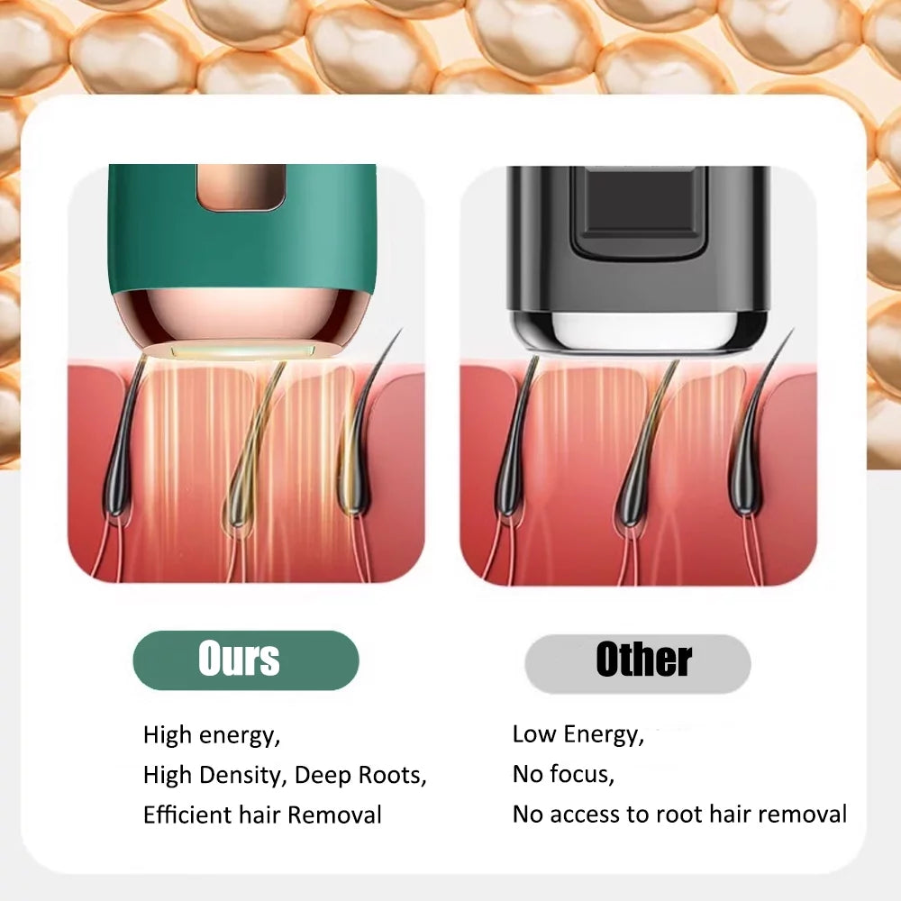 Laser Hair Removal for Women and Men with Cooling System,Upgraded to 990,000 Flashes Hair Removal Device on Facial Legs(Green)